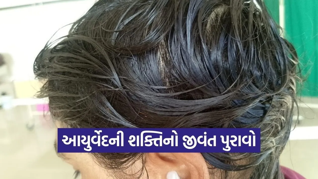 Gandhinagar Ayurveda Hair Regrowth Case 2026 1.jpg