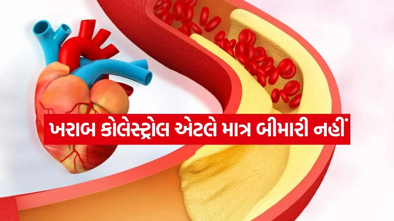 Cholesterol 0703.jpg