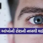 eye care 1003