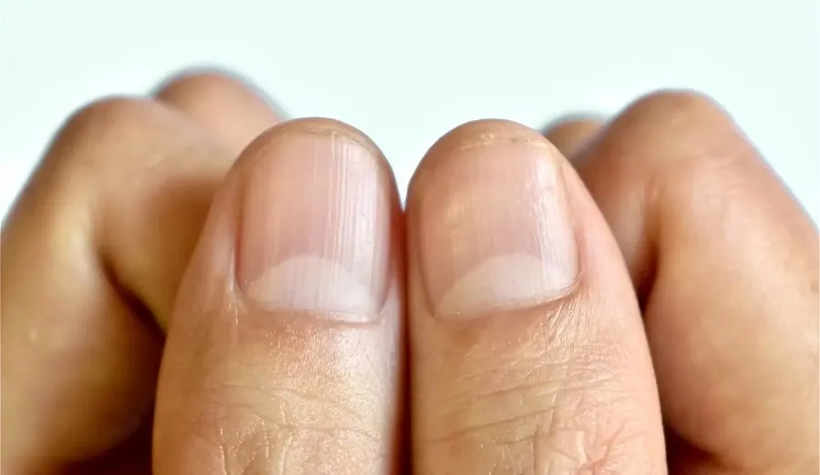 half-moon on nails