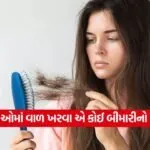 hair loss