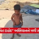 Dahod Malnutrition Child Recovery CMAM Program Success 1