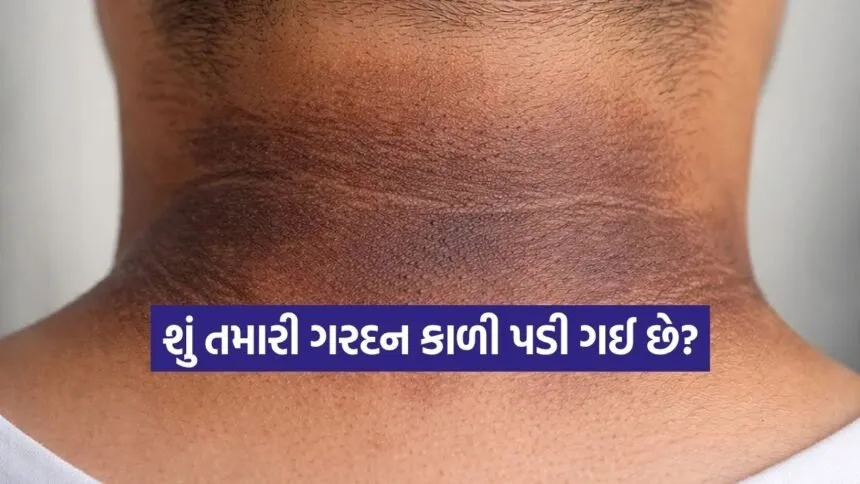 INDIA 1 1