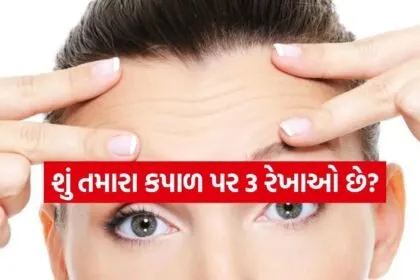 Forehead Lines