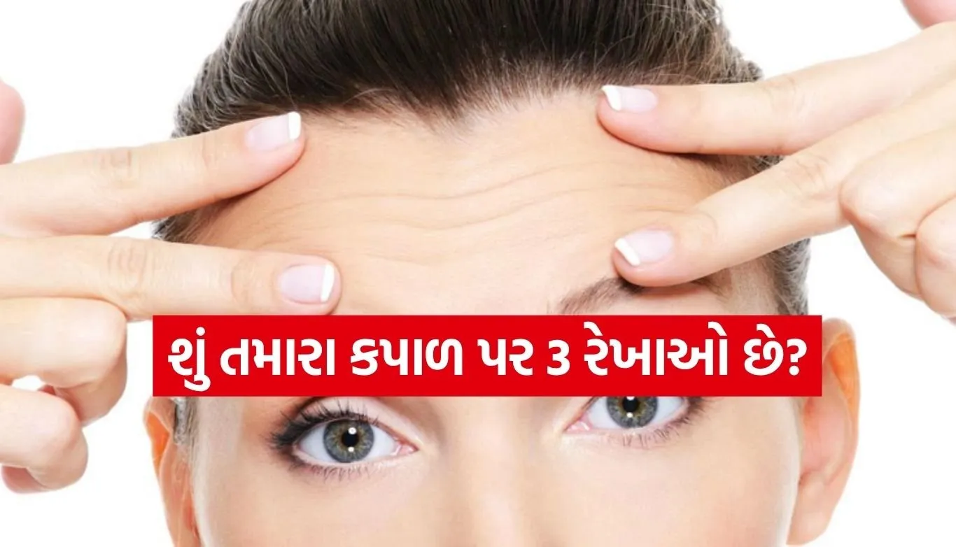 Forehead Lines