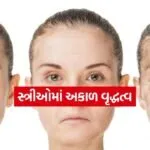 Premature age women 0604