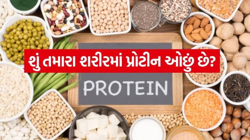 Protein 3004