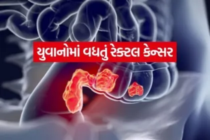 rectal cancer 0305