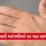 Hair On Fingers