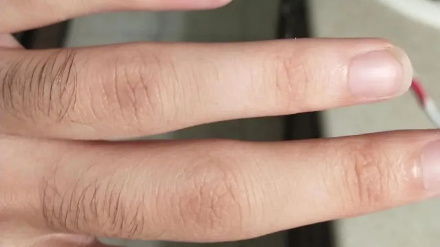 Hair On Fingers