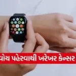 Smartwatch