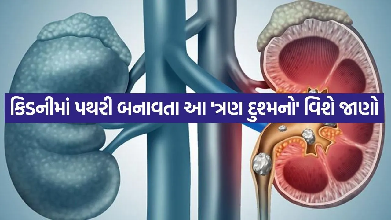 Kidney 0805.jpg