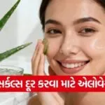 Aloe vera 3005