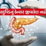 Pancreatic cancer 0206