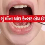 Oral cancer 2606