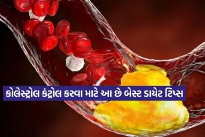 cholesterol1