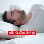 Sleep Apnea2