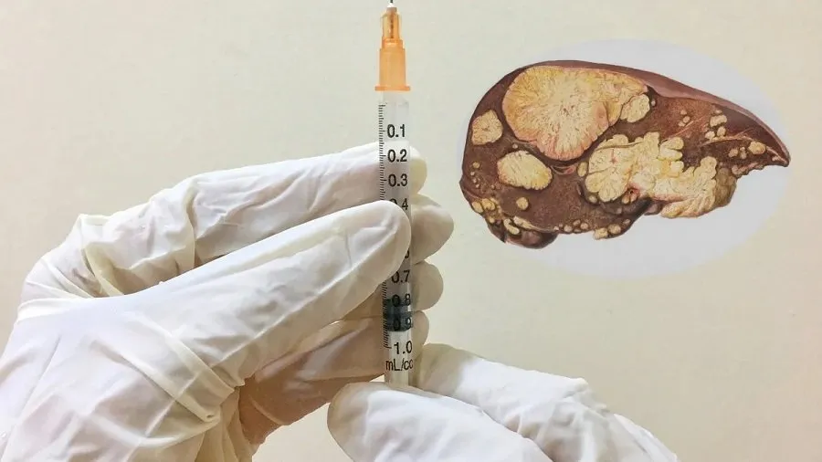 liver.jpg