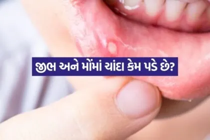 Mouth Ulcers
