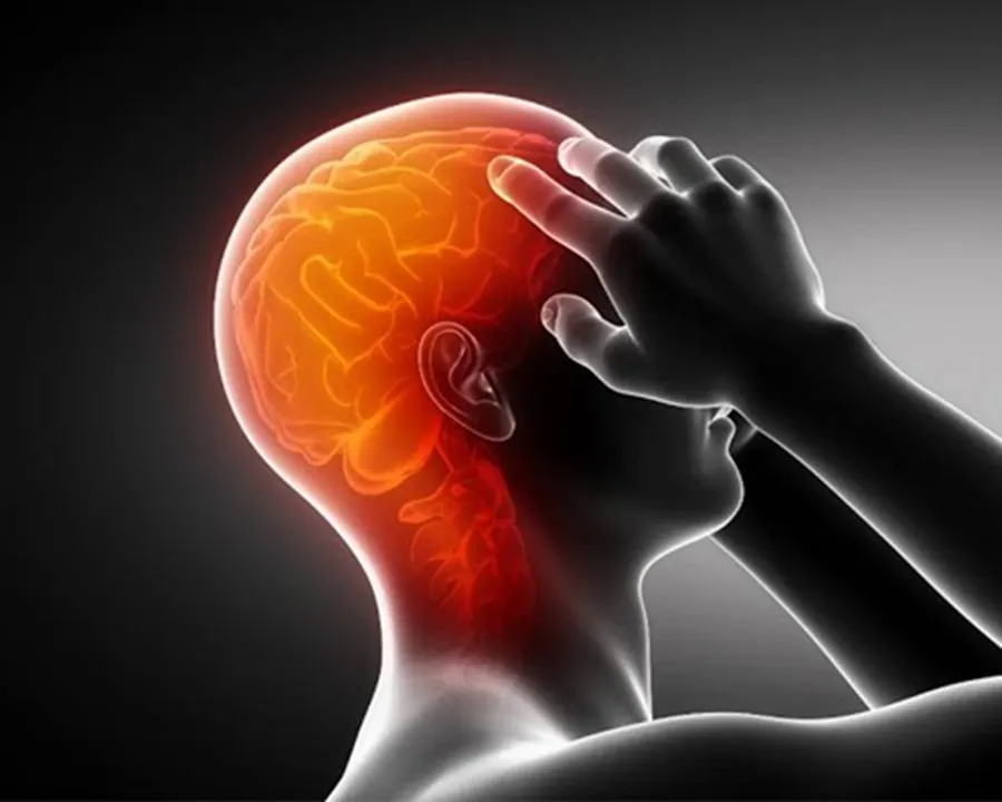Migraine.jpg