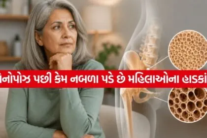 Post Menopause Bone Health