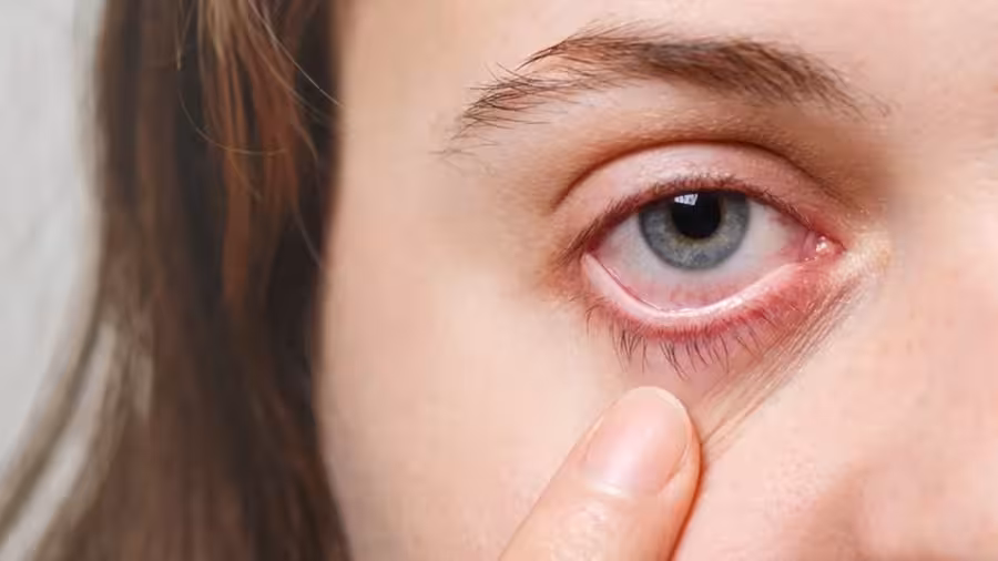 eyes.jpg