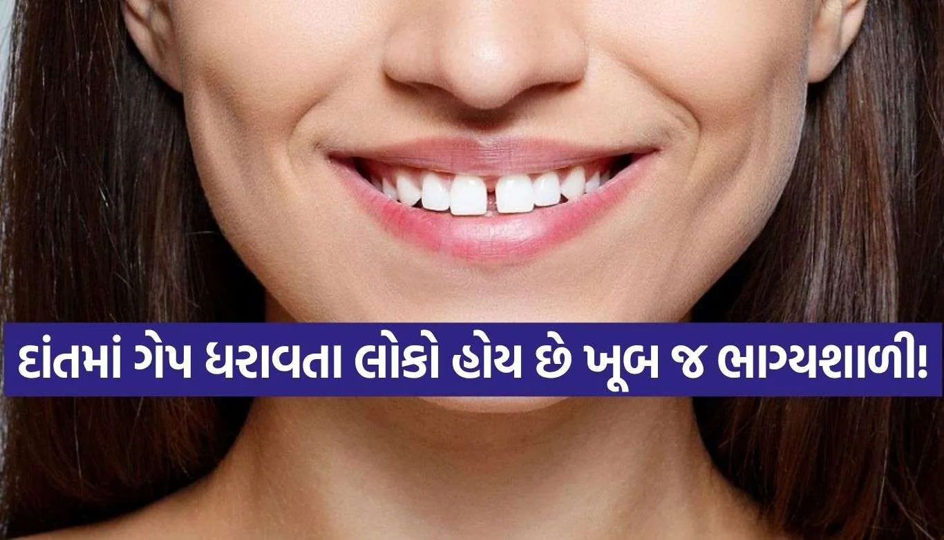 Teeth Gap