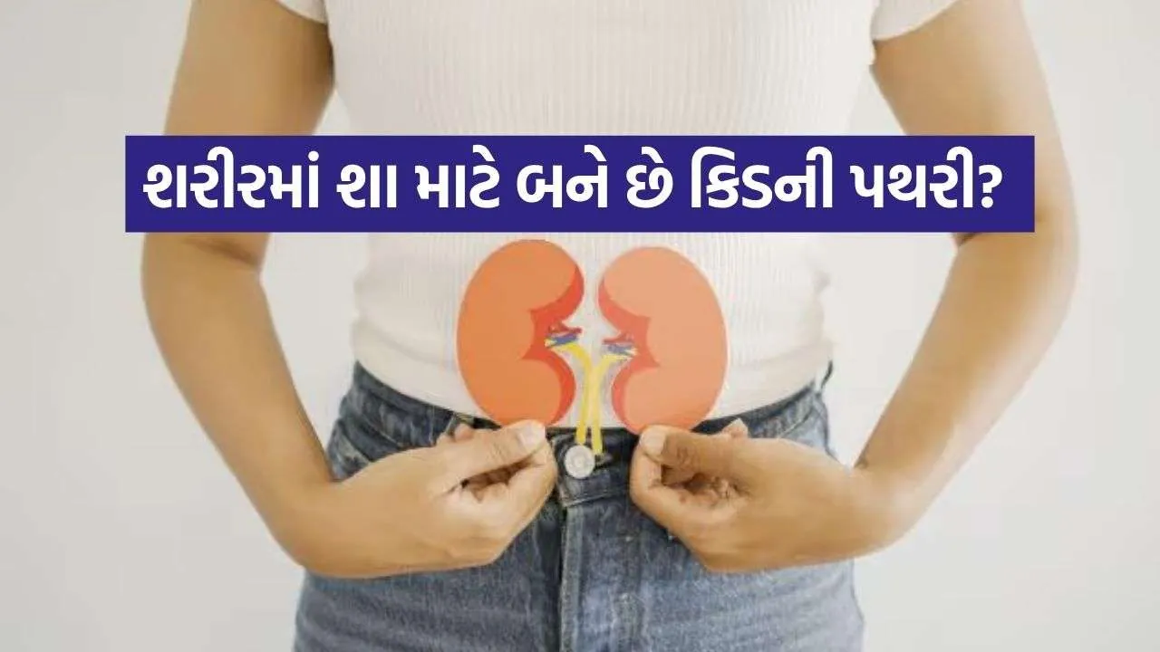 Kidney stone 2908.jpg