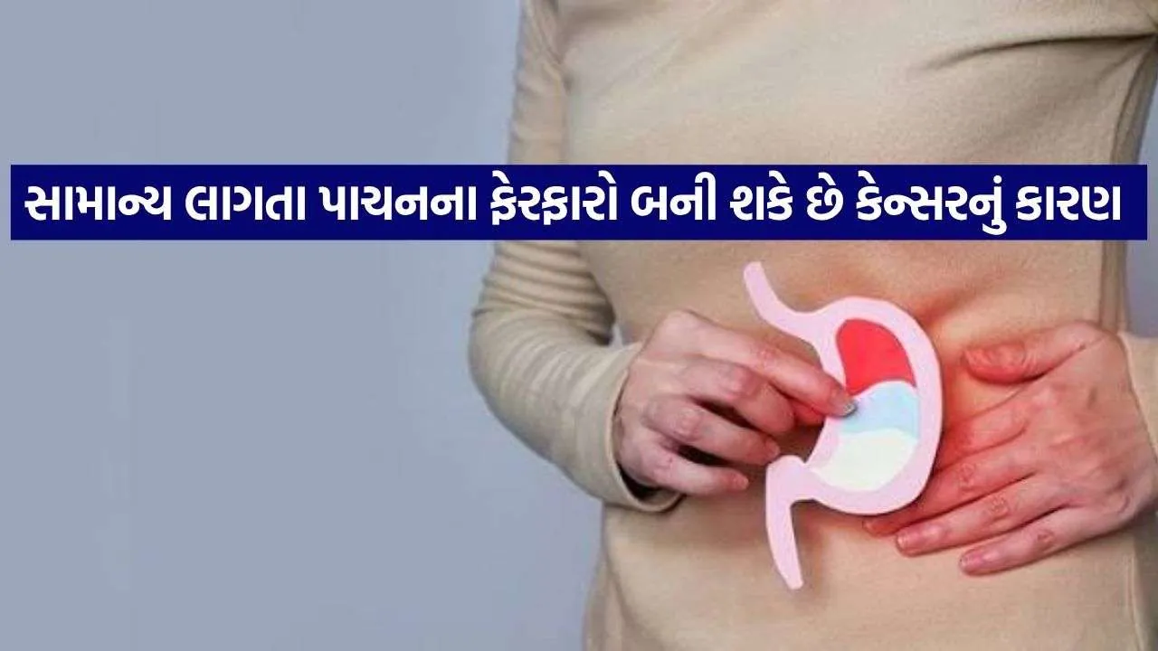 Stomach Cancer 1409.jpg