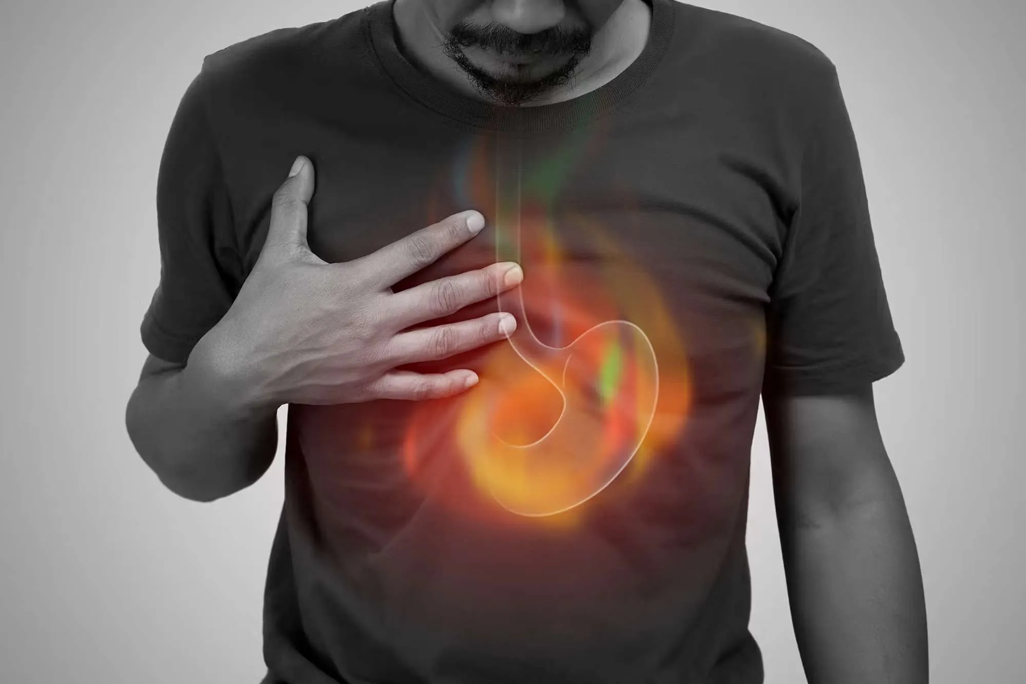 Stomach cancer.jpg