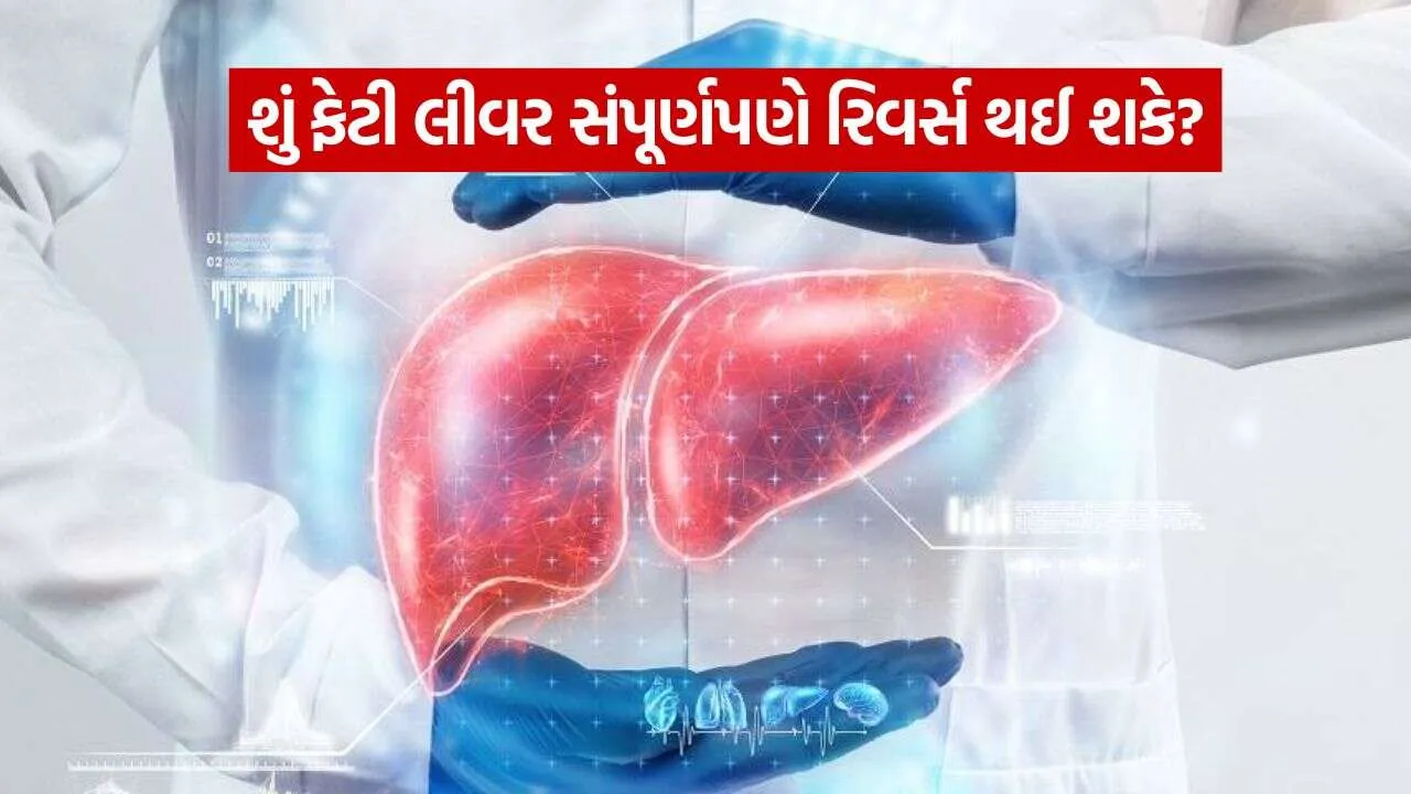 fatty liver 0810.jpg