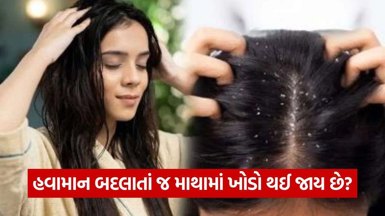 dandruff 1410.jpg
