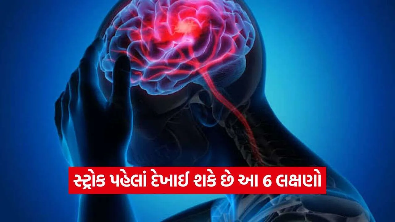 Stroke Symptoms12.jpg